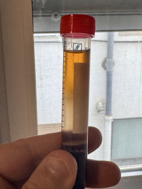 Examining the density gradient tubes