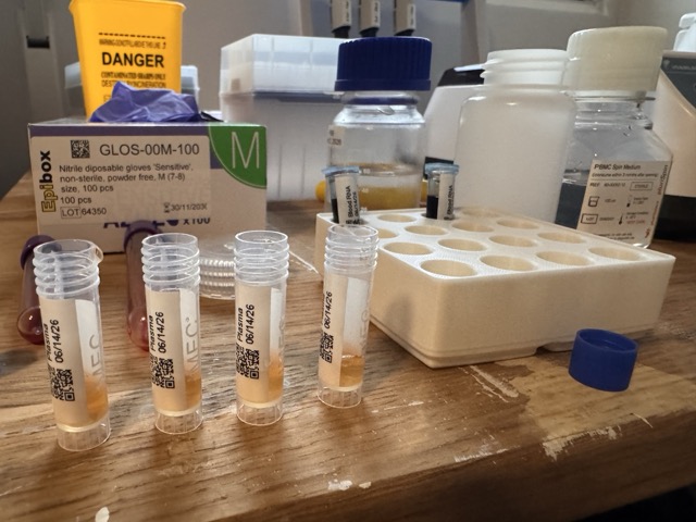 Saving the plasma in cryovials